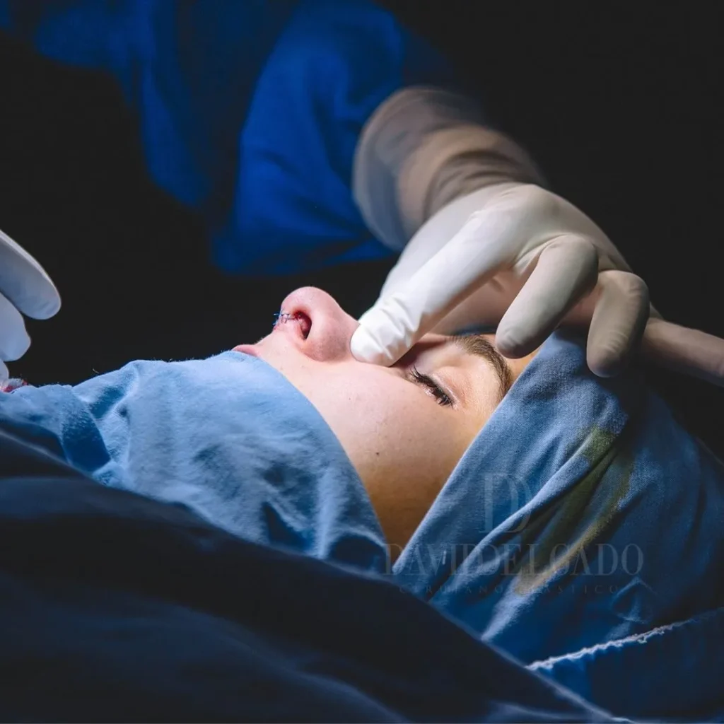 Dr david delgado best plastic surgeon in colombia
