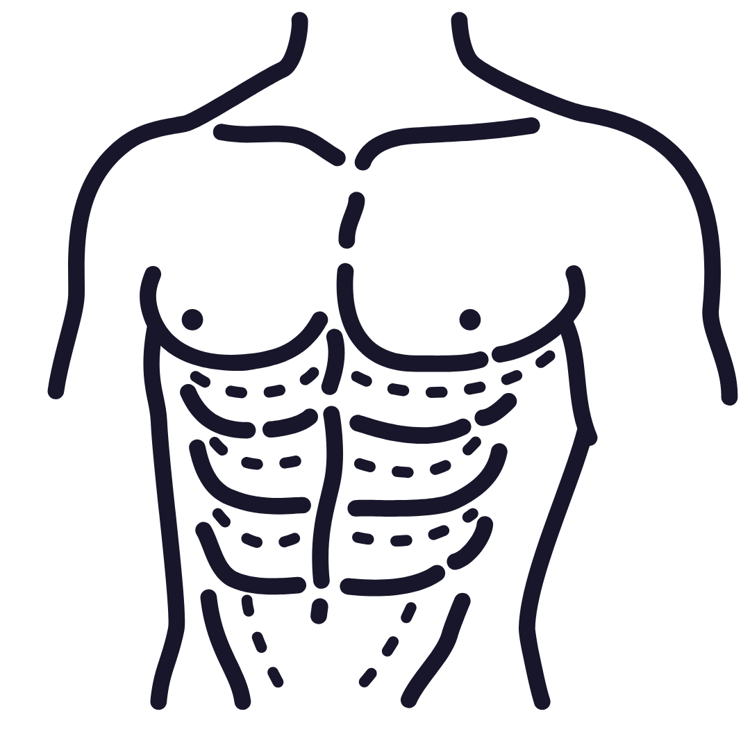 Marcación Abdominal