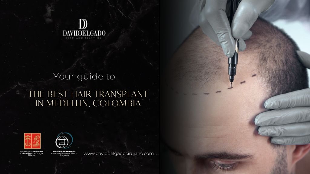 Hair transplant in Medellín Colombia - Dr. David Delgado