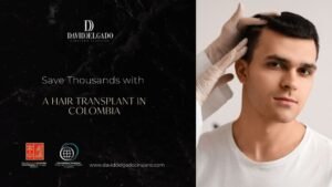 Hair Transplant Colombia Cost expleined By Dr. David Delgado - Be Dharma Hair