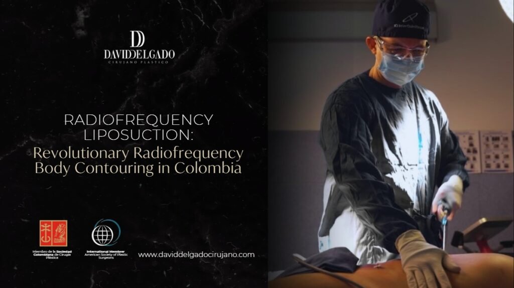 Radiofrequency liposuction- Dr. David Delgado
