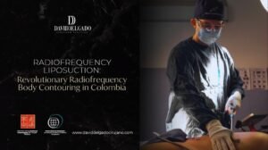 Radiofrequency liposuction- Dr. David Delgado