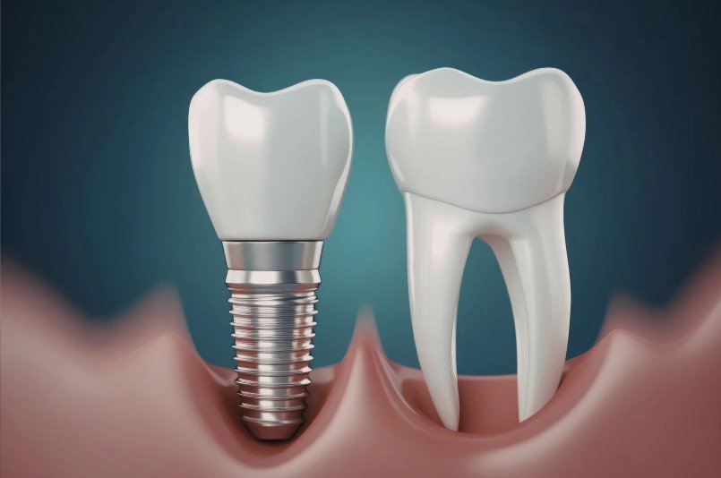 Clínica Be Dharma Dental-Dr. David Delgado