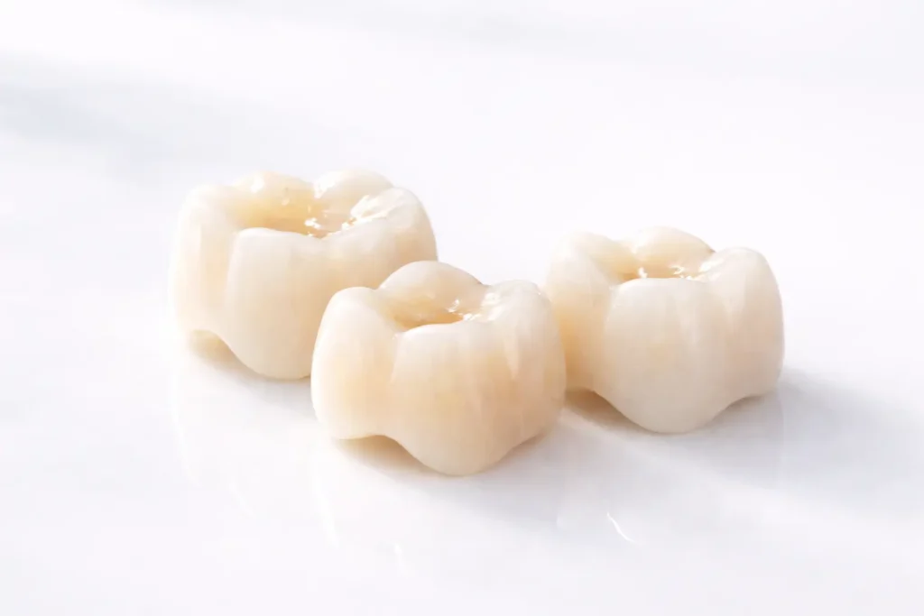 Dental Crowns in Medellin- Plastic Surgery Medellín