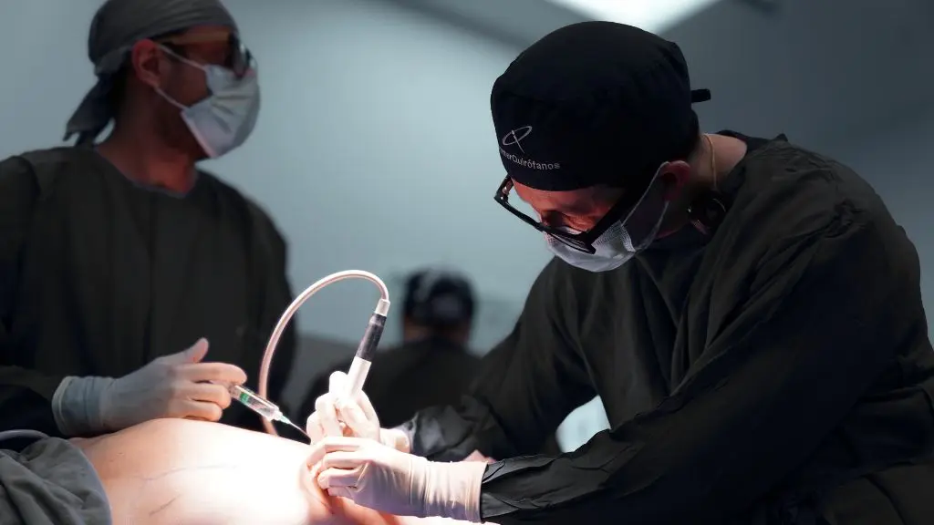 Rib removal cosmetic procedure by dr. David Delgado in Medellin, Colombia