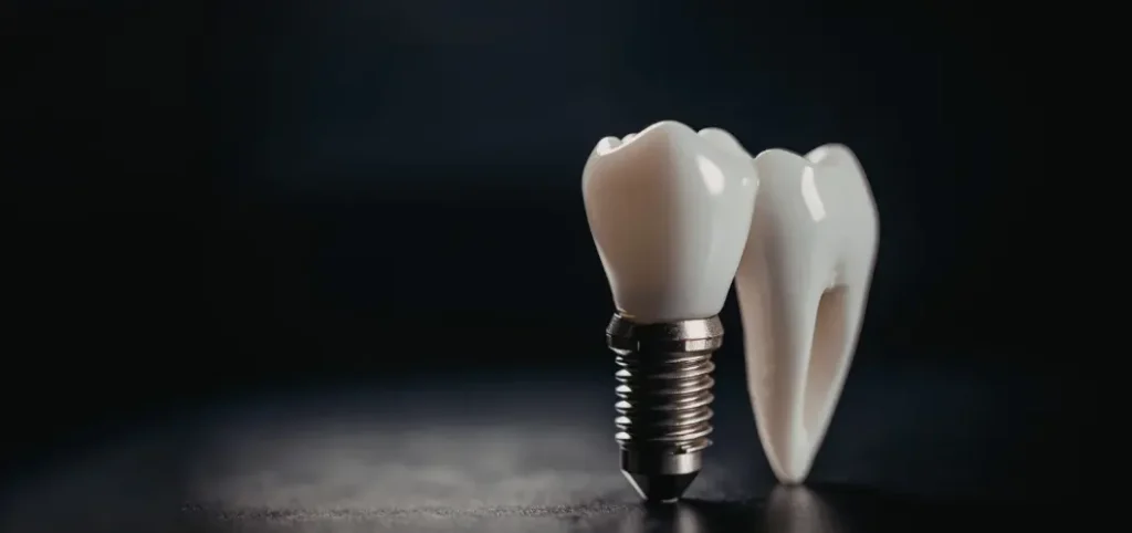Dental Implants cost in Torre Médica de Oviedo- Plastic Surgery Medellín