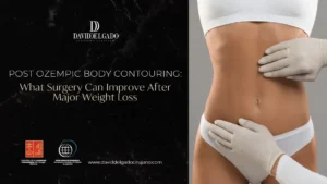 post-Ozempic body contouring - Dr. David Delgado Medellín- Plastic Surgery