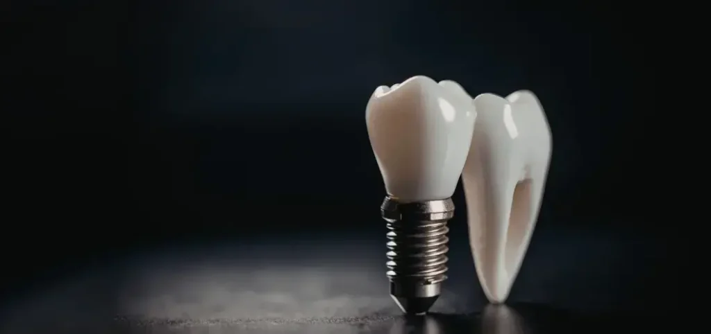 Dental Tourism in Colombia- Plastic Surgery Medellín