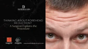 Forehead Surgery Reduction- Dr. David Delgado- Plastic Surgery